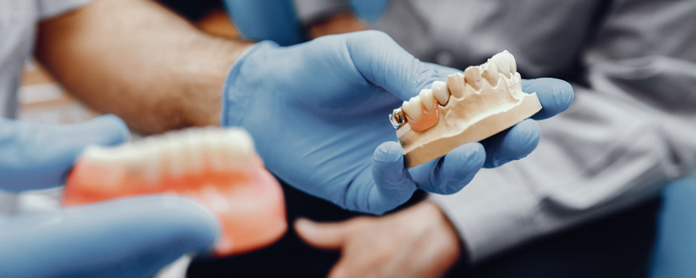 Diş implantı hangi durumlarda kullanılır?