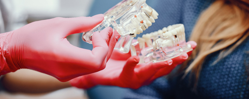 Diş implantı nedir?