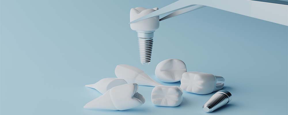 Nişantaşı implant diş tedavisi