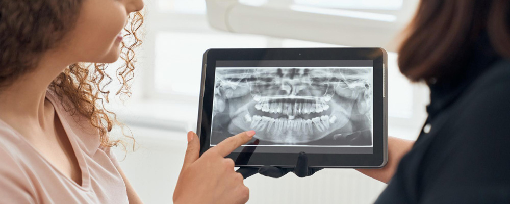 Implant diş tedavisi hem alt hem üst çeneye yapılabilir mi?