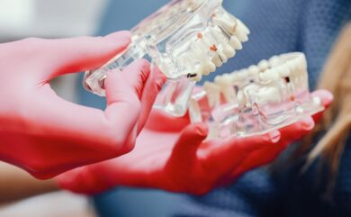 Preise für Implantate in Antalya