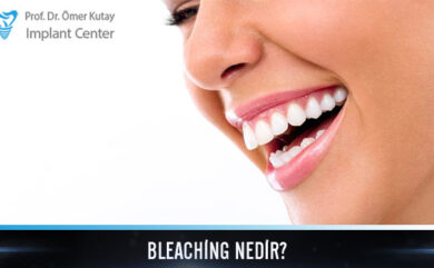 Qu'est-ce que le blanchiment ?