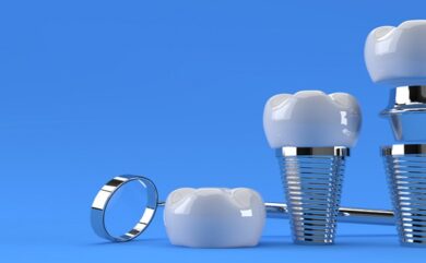 Preise für Canakkale-Implantate