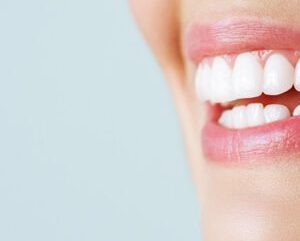 Wie lange dauert die gesamte Behandlung mit Zahnimplantaten?