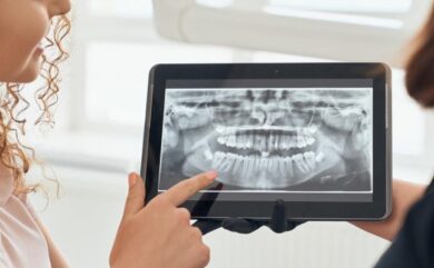 Zahnfleischrückgang, Osteoporose und Implantatbehandlung