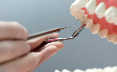 Verursachen zu viele Implantate Gewicht im Mund?