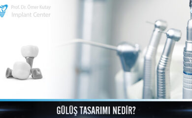 Qu'est-ce que Smile Design ?