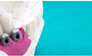 Is the Implant Screw Visible?