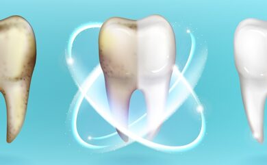 Qualität der Implantate