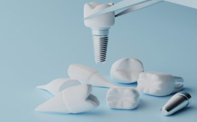 Que peut-on faire pour les dents foncées ?