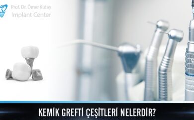 Welche Arten von Knochentransplantaten gibt es?