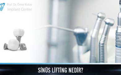 Was ist ein Sinuslift?