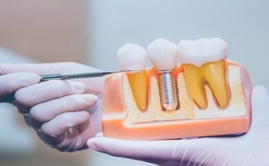 Türk malı implant (vidalı diş) güvenli midir?